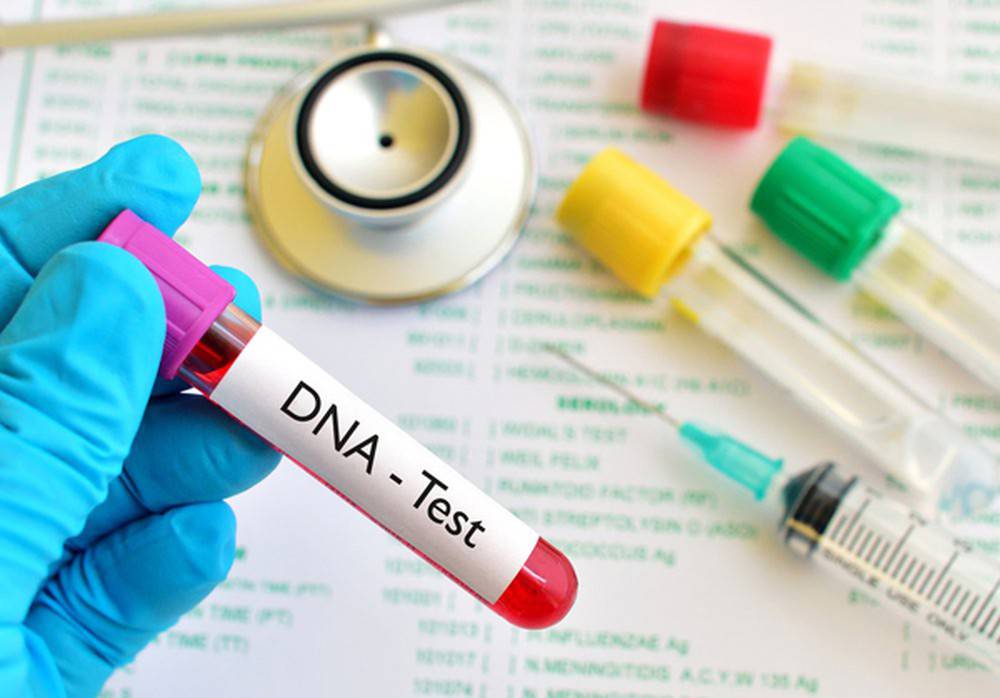Xét nghiệm ADN chẩn đoán bệnh gì? và hướng dẫn đọc kết quả